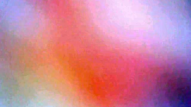examination of the urethra and bladder with an endoscope