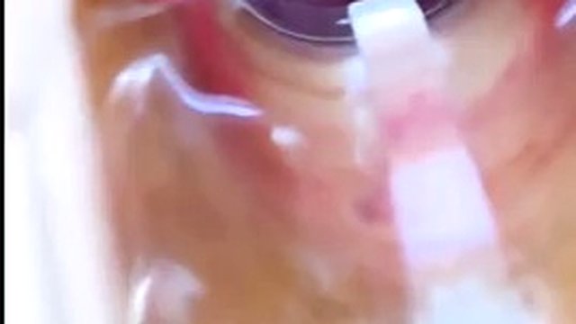 Vagina, cervix Rhythmically hit the orgasm vaginal endoscope with strong suction, squeezing and raising the spike.