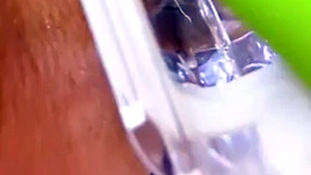 Vagina, cervix Rhythmically hit the orgasm vaginal endoscope with strong suction, squeezing and raising the spike.